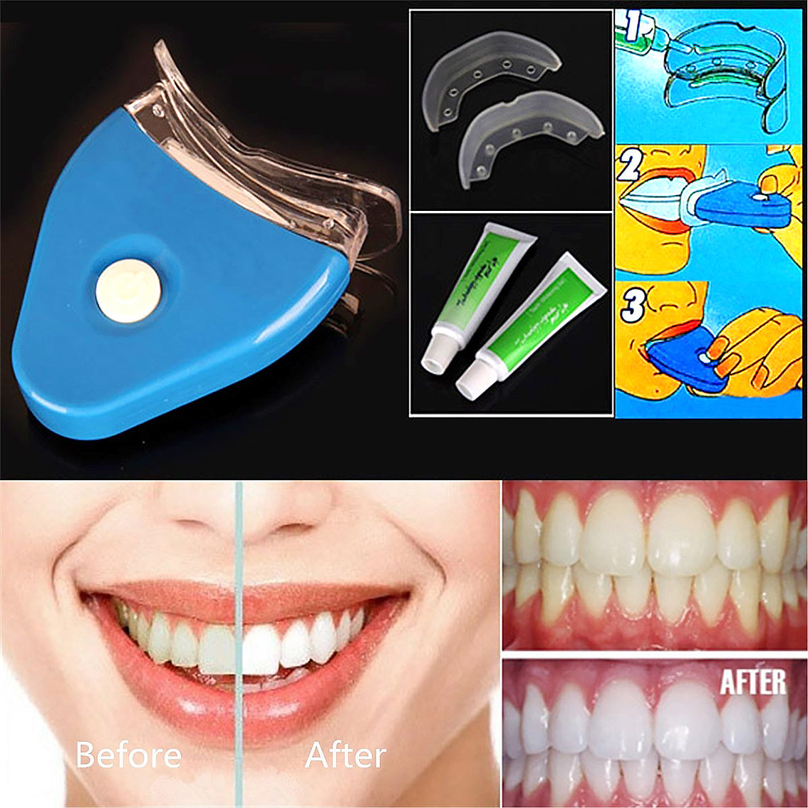 How does the LED Tooth Whitening Gel help achieve a brighter smile?